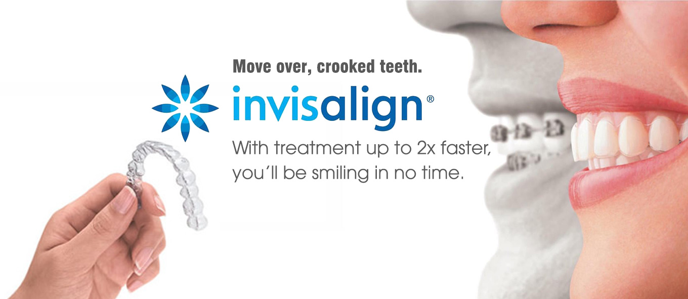 Invisalign - The clear alternative to braces